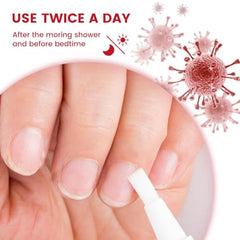 NOVOLAN Nail Repair Pen 4ml Antifungal Solution for Nail Repair, Targets Discoloration Gray & Black Nails, Antibacterial Pen for Nail Care, Enhances Nail Thickness & Cleanliness, Restores Healthy Nail
