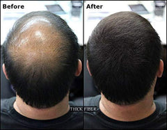 THICK FIBER Hair Building Fibers for Thinning Hair & Bald Spots (BLACK, Pack of 2) - 25g Bottle - Conceals Hair Loss in Seconds - Hair Fiber concealer for Men & Women
