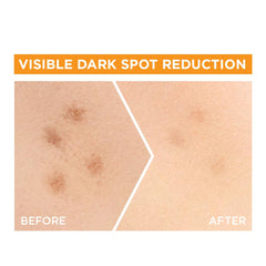 Garnier SkinActive Fast Bright 30x Vitamin C Booster Serum, Anti Dark Spot - Twin Pack, 30ml x2