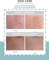 Dermamax Professional Serum, Premium Booster Treatment, for skin care 10 Vials | all skin,Anti-aging,Anti-wrinkle,shiny,Moisturising |ideal with Microneedling Dermaroller| (10 * 8ml) | Made in Korea