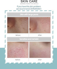 Dermamax Professional Serum, Premium Booster Treatment, for skin care 10 Vials | all skin,Anti-aging,Anti-wrinkle,shiny,Moisturising |ideal with Microneedling Dermaroller| (10 * 8ml) | Made in Korea