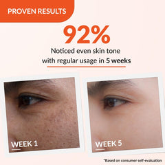 Fixderma Tranexamic Acid + 2% Kojic Acid + 1% Arbutin SKARFIX -TX Face Cream | Pigmentation Removal Cream | Kojic Acid Cream | Uneven Skin Tone - 30 gm