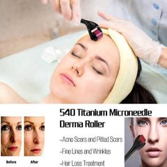 Showay Derma SanBiz 0.5mm Derma Roller 540 Needles Hair Growth Roller,Titanium Micro Wrinkle Anti Aging Acne Scar Stretch Mark Treatment Micro Needling Face Care Massage Tool with Transparent Box