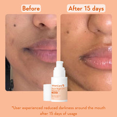 WishCare Super Bright C16 Vitamin C Serum for Oily Skin, Dry & Combination Skin -10% Vitamin C, 4% Niacinamide,1% Kojic Acid, 0.5% Ferulic Acid, Licorice & 4-n-BR- Serum For Pigmentation & Dark Spots