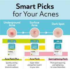 DERMA ANGEL Ultra Invisible Acne Patches for Face Pimple Patches Hydrocolloid Patches Zit Patches Acne Stickers Exposed Skin Care Acne Treatment - Day and Night Use 240 pieces 3 Sizes