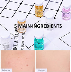 JEMPET Hyaluronic Acid Serum Ampoule Set (12 Vials) for Microneedling Skin Spa Treatment