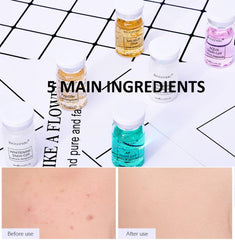 JEMPET Hyaluronic Acid Serum Ampoule Set (12 Vials) for Microneedling Skin Spa Treatment