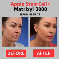 DERMA CLINICALS Apple Stem Cell + Matrixyl 3000 Serum With Hyaluronic Acid, Peptide Serum, Anti-Aging Serum for face, Anti-Wrinkle Serum, Skin Care Product - 4 oz