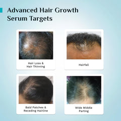 Pilgrim 3% Redensyl, 4% Anagain Advanced Hair Growth Serum Roll-on for Scalp with Korean Black Rice & Rosemary | Control Fall, Stimulate Regrowth, Increase Density | For Women & Men (25ml)