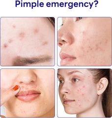 Mediheal Derma Clear Madecassoside Blemish Spot Patch (132)