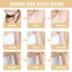 Meanju Hair Growth Inhibitor Serum, Natural Hair Remover, Hair Removal for Face, Armpits, Legs and Arms, for Long-Term Smooth Skin and Easy Hair Growth Management