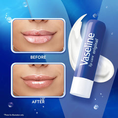Vaseline Lip Therapy Original Lip Balm With Pure Jelly & Vitamin E For Soft & Glossy Lips| Nourishes & Protects Lips| Non-greasy Lip Moisturizer for Naturally Tinted Lips| 4.8 gm