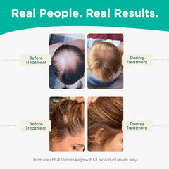 Hair Loss Leave-in Conditioner | All-Natural DHT Blockers for Thinning Hair Developed by Dermatologists | Experience Healthier, Fuller and Thicker Looking Hair - Shapiro MD | 1-Month