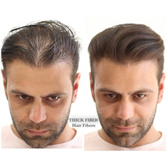 THICK FIBER Hair Fibres for Thinning Hair (Pack of 1 DARK BROWN) | Hair Powder for Thinning Hair 12g Bottle | Make Hair Look Thicker in Seconds | Hair Loss Concealer for Women & Men