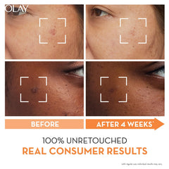 Olay Super Serum: Luminous Serum With Niacinamide + Vitamin C For Even & Glowing Skin, Sulphate & Parbene Free, 30 ML