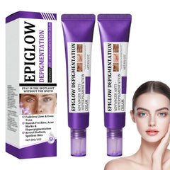 Epiglow Melanex Advanced Anti-Hyperpigmentation Cream, Anti Ageing Face Cream, Dark Spot Remover for Face, Brightening Freckle With Niacinamide, Tone Correcting Moisturizer, Reduces Wrinkles (2)