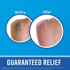 O'Keeffe's 3oz Healthy Feet Tube