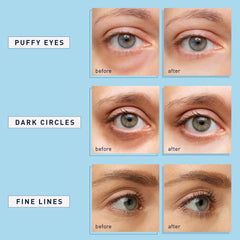 Enaskin Naturals Under Eye Patches for Dark Circles: 30 Pairs Collagen Eye Gels Pads - Reduce Wrinkles Puffy & Bags - Retinol Skin Treatment Mask - Anti Aging Face Moisturizer For Women & Men (Blue)