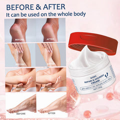40% Urea Cream for Dry Foot, Cracked & Scaly Skin Moisturizing Hand Cream with 2% Salicylic Acid & Hyaluronic Acid, for Callus Treatment on Hands, Heels, Elbows, Nails & Knees