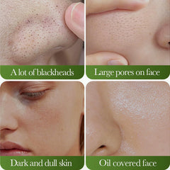 Organic Vegetable & Fruit Face Mask, 2.7% Azelaic Acid β Exfoliating, Pore Minimizer, Hydrating & Refreshing Skincare for Acne, Oily Skin & Blackheads