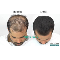 THICK FIBER Hair Building Fibers for Thinning Hair & Bald Spots (BLACK, Pack of 2) - 25g Bottle - Conceals Hair Loss in Seconds - Hair Fiber concealer for Men & Women