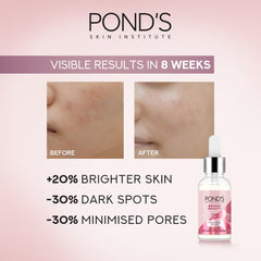 POND'S Bright Beauty Triple Glow Serum, with Niacinamide and Hyaluronic Acid, 30g