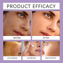 Epiglow Melanex Advanced Anti-Hyperpigmentation Cream, Anti Ageing Face Cream, Dark Spot Remover for Face, Brightening Freckle With Niacinamide, Tone Correcting Moisturizer, Reduces Wrinkles (3)