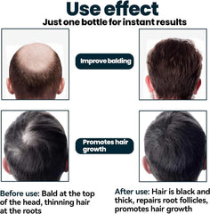 Hair Growth Serum for Hair Loss and Regrowth - 60ml*3 Ginger Solution for Men - Hair Follicle Repair Treatment