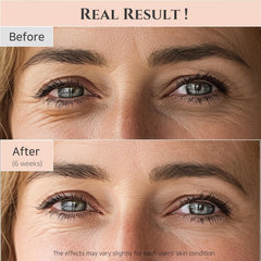 Beauty of Joseon Korean Eye Serum: Ginseng + Retinal 30ml, Pink, 1 Fl Oz (Pack 1)