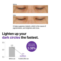 SOME BY MI Retinol Intense Advanced Triple Action Eye Cream | Mild Overnight Korean Anti-Aging Eye Cream | for Dark Circles & Fine Lines | Ideal for Retinol Beginners | 1.01Oz - 30ml