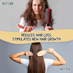Milva Caffeine and Quinine Shampoo 200ml | Against Hair Loss and Stimulates Hair Growth | Strengthens Hair Roots | Strong Hair Scalp | Anti-Hair Loss Shampoo| Hair Thickening Treatment for Women & Men