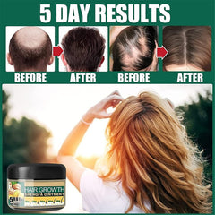 Natural Ginger Hair Growth Cream,Hair Boost Ginger Ointment,Anti-Hair Loss Conditioner For Men Women (3pcs)