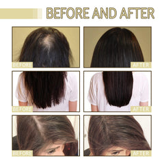Veganic Rosemary Hair Growth Oil for Dry, Damaged & Thin Hair, Nourishing Unisex Formula (3 x 60ml)