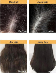 OSYA Sakura Japanese Shampoo,Sakura Japanese Shampoo for Hair Loss,Sakura Hair Growth Japan's No. 1 Shampoo,Sakura Japanese Shampoo and Conditioner,300ml Create Thick, Shiny Hair (Shampoo)