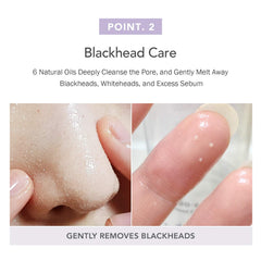 Celimax Derma Nature Fresh Blackhead Jojoba Cleansing Oil - Light, Non-Greasy MakEUp, Clogged Pores, Blackheads Dissolving Formula, 150 Milliliter