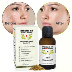 Drsous Ca Chamomile Essential Oil 30ml | 100% Pure Cold Pressed Undiluted Chamomile Vegan Cruelty Free Therapeutic Grade Oil for Diffuser, Aroma, Skin care, Hair care | Made in Palestine