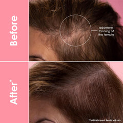 Grande Cosmetics Hair Serum for Men & Women, Thickens Thinning Hair, Safe for Color Treated Hair | 40ml