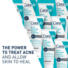CeraVe Acne Foaming Cream Cleanser, 5 Fl Oz (Pack of 1), Packaging may Vary
