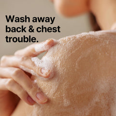 SOME BY MI AHA BHA PHA 30 Days Miracle Acne Clear Body Cleanser - Pack of 2 - Daily Exfoliating Tea Tree Acne Body Wash with Salicylic Acid - Deep Cleanses Sebum and Impurities - Korean Skin Care