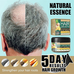 Natural Ginger Hair Growth Cream,Hair Boost Ginger Ointment,Anti-Hair Loss Conditioner For Men Women (3pcs)