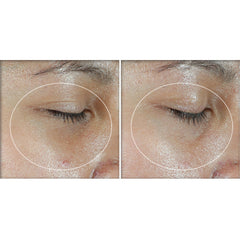 RoC - Multi Correxion Revive + Glow Eye Balm - Includes Vitamin C - Hypoallergenic - 4g