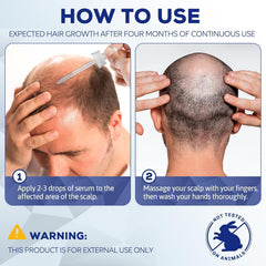5% Minoxidil for Men and Women, Hair Regrowth Treatment for Thinning Hair and Hair Loss, Topical Solution - 2 Months Supply - Dermatologist recommended (Pack of 2)