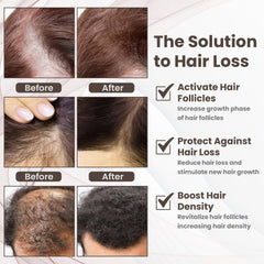 Copper Peptide 10% GHK-CU, 5% AHK-CU peptides Hair Growth Treatment Serum