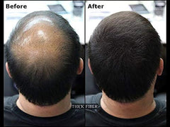 THICK FIBER Hair Building Fibers for Thinning Hair & Bald Spots (BLACK, Pack of 3) - 25g Bottle - Conceals Hair Loss in Seconds - Hair Fiber concealer for Men & Women