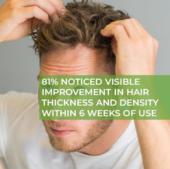 truth Men's Daily Hair Fuel 30ml RU58841 5% + REDENSYL 5% + PROCAPIL 5% + BAICAPIL 5% + ANAGAIN 5% + CAPIXYL 5% + AZELAIC ACID 3% + BIOTIN 2% + VITAMIN B5 2% FORMULATED IN KOREA