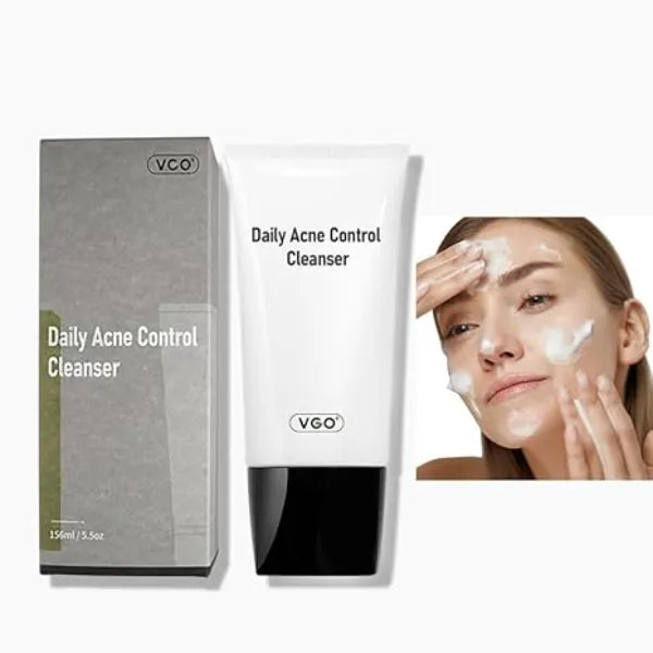 VGO Acne Control Hydrating Facial Cleanser, Cleanser for Oily Skin Blackhead Remover and Clogged Pore Control Non Comedogenic, 156ml / 5.5oz