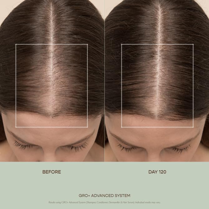 VEGAMOUR GRO+ Advanced Balancing Conditioner | Hydrates the Scalp, Nourishes and Softens Hair | For Severe Signs of Thinning | Color Safe, Vegan, Cruelty-Free, Formulated Without Silicones (8 Fl Oz)