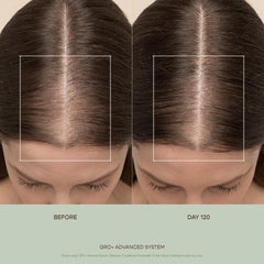 VEGAMOUR GRO+ Advanced Balancing Conditioner | Hydrates the Scalp, Nourishes and Softens Hair | For Severe Signs of Thinning | Color Safe, Vegan, Cruelty-Free, Formulated Without Silicones (8 Fl Oz)