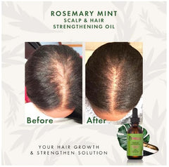 Mielle Natural Rosemary Essential Oil For Hair Growth & Strengthening Oil 59 ML