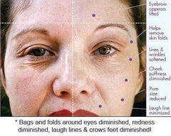 POXEFLIP Deluxe Skin Quench Derma Vital Skincare Products With Makeup Bag Face Lift High Frequency Machine Makeup Bag
